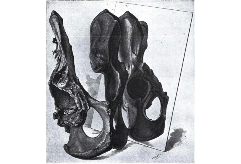 A sketch of the saber-toothed cat pelvis. A mirror reflects the healthy side of the hip, while the contorted side faces outward.